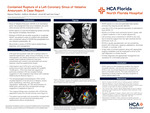 Contained Rupture of a Left Coronary Sinus of Valsalva Aneurysm: A Case Report