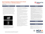 Rare Presentation of Primary Malignant Peripheral Nerve Sheath Tumor of the Femur in Neurofibromatosis-1