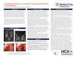 A Challenging Diagnosis of Intestinal Tuberculosis Mimicking Crohn's Disease