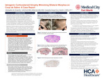Bilateral Corticosteroid Atrophy Mimicking Morphea en Coup de Sabre: A Case Report