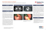 Rare Rectal Lipoma Case Report by Victoria Nguyen, Sean Sojdie, Kunal Elete, Justin Richardson, and Long Hoang