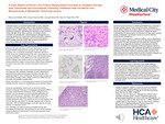 A Case Report of Florid Liver Failure Responding Favorably to Targeted Therapy with Cetuximab and Encorafenib Following Treatment with Irinotecan and Bevacizumab in Metastatic Colorectal Cancer by Maryam Fallahi, Omar Garcia, and Joseph Kim
