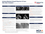Antibody-Mediated Allograft Rejection 23 Years After Heart Transplant