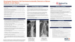 Esophageal Squamous Cell Carcinoma Incidentally Detected on Barium Swallow: A Case Report