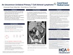 An Uncommon Unilateral Primary T Cell Adrenal Lymphoma by Kiranpreet Gosal, Mitsy Moreno Moreno Barr, David Moccia, and Pooja Patel