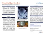 A Beach Ball Sized Liver Cyst by Stephen C. Music, Elise Steinberger, and Andrew Mangano