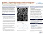Acute Rise in Prostate Specific Antigen Found to have Isolated Brain Metastasis from Recurrent Prostate Adenocarcinoma: Case Report by Kevin Dao, Kevin Parza, Nicolina Scibelli, Zoe Lombard, and Victor Collier