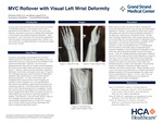 MVC Rollover with Visual Left Wrist Deformity