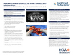 Perforated Sigmoid Diverticulitis Within A Strangulated Inguinal Hernia