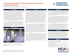 Thoracic Radiculopathy Following Permanent Spinal Cord Stimulator Placement