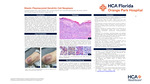 Blastic Plasmacytoid Dendritic Cell Neoplasm by Jacquelyn Medina, Adam Chahine, Courtney Bernett, and Karthik Krishnamurthy