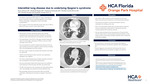 Interstitial Lung Disease Due to Underlying Sjogren's Syndrome by Ryan E. Johnson, Elizabeth Bogaty, Chamonix Kinimaka, and Marilian Canals-Rivera