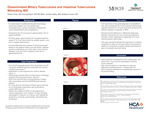 Disseminated Miliary Tuberculosis and Intestinal Tuberculosis Mimicking IBD