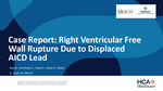 Case Report: Right Ventricular Free Wall Rupture Due to Displaced AICD Lead
