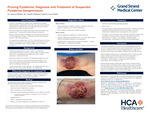Proving Pyoderma, Diagnosis and Treatment of Suspected Pyoderma Gangrenosum by Samuel Milam and Sean Gibbs