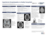 Hyperthermic Encephalopathy in a Healthy Young Adult by Timothy Kocher and Dhruvkumar Patel