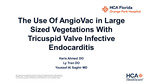 The Use of AngioVac in Large Sized Vegetations With Tricupsid Valve Infective Endocarditis