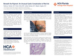Beneath the Pigment: An Unusual Cystic Complication of Red Ink