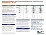 A Case of the Bone Pain: Differentiating between Metastatic Prostate Cancer and Paget’s Disease of the Bone