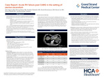 Case Report: Acute RV Failure Post CABG in the Setting of Pectus Excavatum