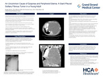 An Uncommon Cause of Dyspnea and Peripheral Edema: A Giant Pleural Solitary Fibrous Tumor in a Young Adult