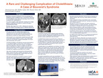 A Rare and Challenging Complication of Cholelithiasis: A Case of Bouveret’s Syndrome