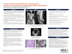 A Case of Disseminated Peritoneal Leiomyomatosis Status Post Total Abdominal Hysterectomy Without Morcellation