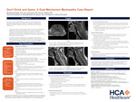 Don't Drink and Game: A Dual Mechanism Myelopathy Case Report