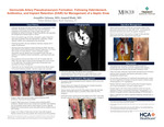 Geniculate Artery Pseudoaneurysm Formation  Following Debridement, Antibiotics, and Implant Retention (DAIR) for Management of a Septic Knee