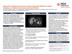 Diagnostic Persistence Uncovers Hepatic Abscesses Missed on Initial Imaging in an Elderly Immunocompromised Patient
