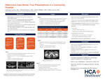 Hibernoma Case Series: Four Presentations in a Community Hospital