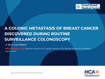 A Colonic Metastasis of Breast Cancer Discovered During Routine Surveillance Colonoscopy: A Rare Case Report