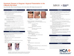Kawasaki Disease in Disguise: Atypical Presentation in the 5-Month-Old Infant
