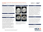 Ulcer Osteoma: The Role of MRI in Differentiating Reactive Proliferative Periostitis from Osteomyelitis
