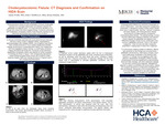 Cholecystocolonic Fistula: CT Diagnosis and Confirmation on HIDA Scan