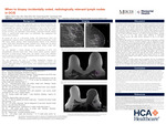 When to Biopsy Incidentally Noted, Radiologically Relevant Lymph Nodes in DCIS