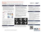 Rare Case of Spontaneous Hepatocellular Carcinoma Regression