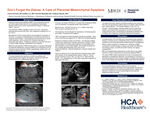 Don't Forget the Zebras: A Case of Placental Mesenchymal Dysplasia