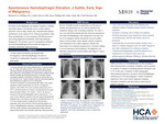 Spontaneous Hemidiaphragm Elevation, a Subtle, Early Sign of Malignancy