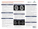 Interpersonal Violent Blunt Head Trauma as a Cause of Acute Ischemic Stroke: A Case Report