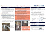Rotator Cuff Tear and Osteonecrosis Secondary to Seasonal Influenza Vaccine by Ryan Wilson, Ryan Hammond, Rachel Turner, and Chae Ko