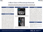 A Rare Cause of Pneumoperitoneum
