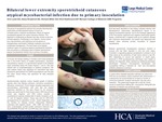 Bilateral Sporotrichoid Cutaneous Atypical Mycobacterial Infection Due to Primary Inoculation by Erin Lowe, Alexa Broderick, and Richard Miller