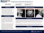 Teriparatide and its Bone Healing Power by Aneeta J. Joseph, Jesus L. Penabad, and Antonio Pinero-Pilona