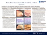 Hailey-Hailey Disease Successfully Treated with Low-Dose Naltrexone by John Moesch and Richard Miller