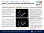 Bedside Point of Care Ultrasound Diagnosing Bilateral Valve Involvement in Infective Endocarditis