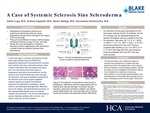 A Case of Systemic Sclerosis Sine Scleroderma