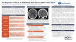 The Diagnostic Challenge of the Pediatric Brain Abscess: A Case Report by Kevin Rivera Rodriguez, Anthony Furiato, Robert Truckner, and Sergio Martinez