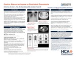 Gastric Adenocarcinoma as Persistent Pneumonia by Aretha Kou, Jinal K. Patel, Itioye Adetula, and Johnathan Frunzi