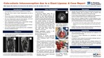 Colo-colonic Intussuseption Due to a Giant Lipoma: A Case Report by Nikita Sijapati, Raj Desai, Ramona Ilie, Mathew Couch, and My Myers